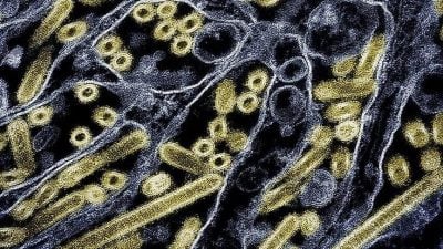 美老翁染H5N5死亡全球首例 卫生部:人类感染风险仍低