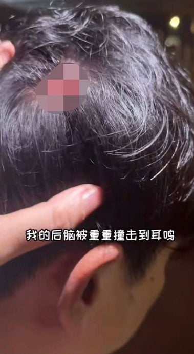 袁锦伦夫妇车祸后脑遭重击 林佩琦惊呼与死神擦肩而过