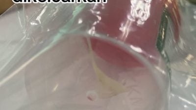 视频| 被鱼刺卡喉住院开刀！ 女子惊险取出“巨刺”还崩了一颗门牙