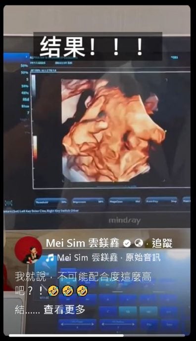 阿哲最后产检喊话“比个YA” 胎儿配合度满分云镁鑫笑哭了