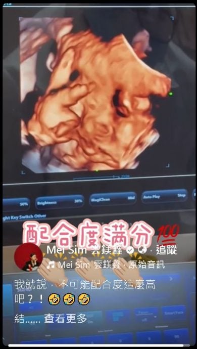 阿哲最后产检喊话“比个YA” 胎儿配合度满分云镁鑫笑哭了