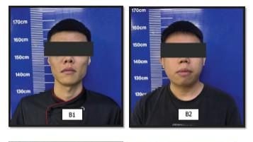 2青年遭围殴受伤  銮警捕5男助查