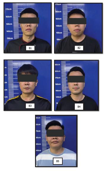 (已签发)柔:2青年遭围殴受伤 銮警捕5男助查