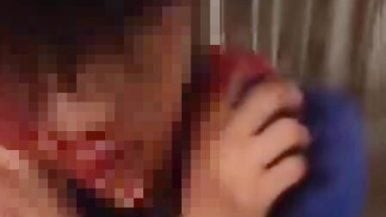 青少年遭人狂掴   满脸血下跪道歉