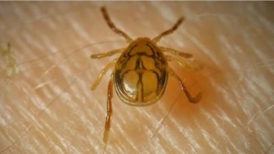 男子死于蜱虫引发的“红肉过敏” 成全球首宗致命个案