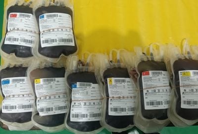 患者动脑手术输血救治 . 血库感谢捐献者支援