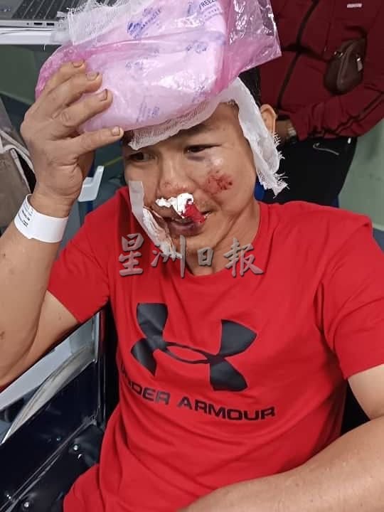 巴占大路车猛撞摩托后逃逸 事主呼吁目击者提供资料