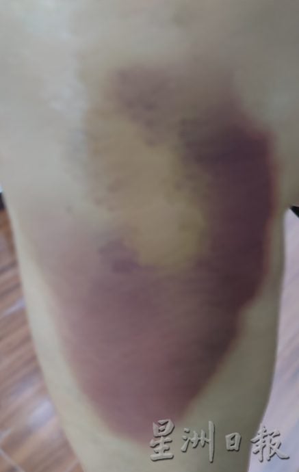 拆停车表后地面未修复 石墩成绊脚石引民怨