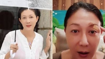 被树叶割伤险毁容    吴绮莉直呼“眼球差点完蛋”