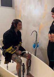 从172长高至183公分　男子花72万做断骨增高手术被讥“没苦硬吃”　	