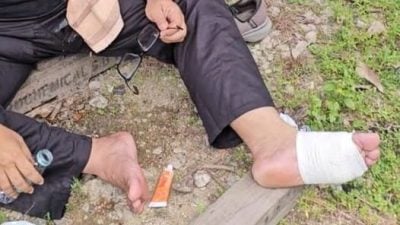 脚部严重起水泡 巴德鲁希山被迫暂停步行抗议