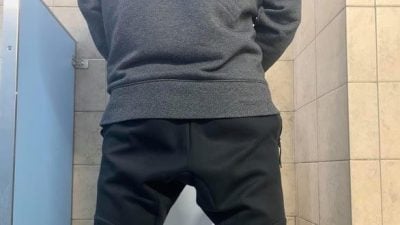 发臭鱼腥味！人夫30年没洗包皮  包皮垢硬成结石