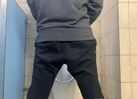 发臭鱼腥味!人夫30年没洗包皮 包皮垢硬成结石