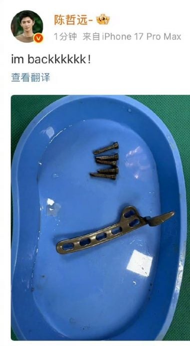 晒带血螺丝与接骨板照片 陈哲远手术成功报平安