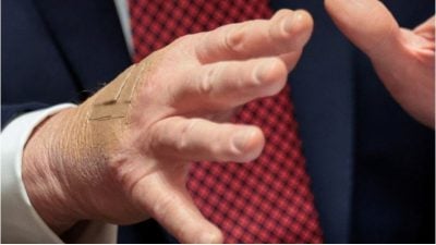 特朗普手背再贴胶布惹关注 白宫：总统一直在握手