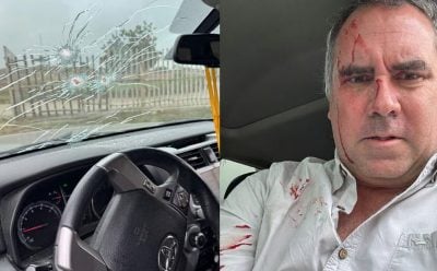 秘鲁总统候选人遇枪击 驳火反击 受伤脱险 