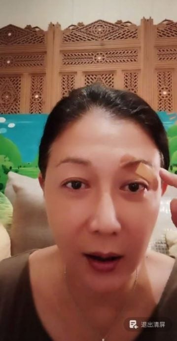 被树叶割伤险毁容 吴绮莉直呼“眼球差点完蛋”