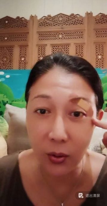 被树叶割伤险毁容 吴绮莉直呼“眼球差点完蛋”