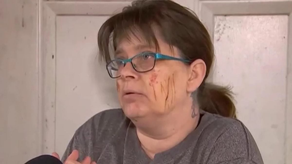 视频/出门找狗瞬间遭猛兽飞扑狠咬 女全身血逃死惊呼:幸好狗没事